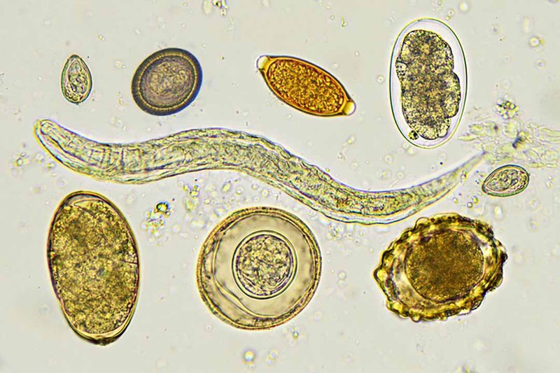 Soi phân qua kính hiển vi tìm thấy trứng hoặc giun trưởng thành